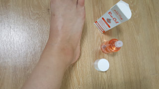 Bio-oil(바이오오일) 바이오오일(Bio-oil) — 4.5점을 준 리뷰어가 2016년 8월 올린 사용 사진