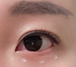 에이엠이 스마트폰으로 인한 눈뻑뻑 해소 AME아이케어밤 베이직 — 4.5점을 준 리뷰어가 2019년 1월 올린 사용 사진
