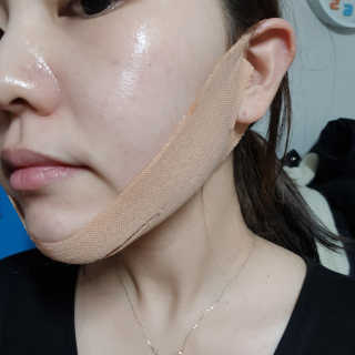 아이디플라코스메틱 아이디 페이스핏 마이너스 밴드 — 5점을 준 리뷰어가 2019년 12월 올린 사용 사진