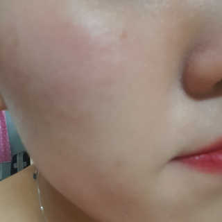 나이팅게일 데일리 더마 클렌징패드 마일드 — 4.67점을 준 리뷰어가 2018년 3월 올린 사용 사진