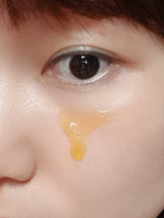 메디페르루테인앰플 3종 — 5점을 준 리뷰어가 2019년 8월 올린 사용 사진