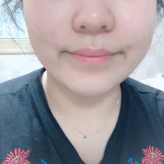 보타니티 [홍]조[진]정[결]케어 플라본 세럼 — 4.83점을 준 리뷰어가 2018년 5월 올린 사용 사진