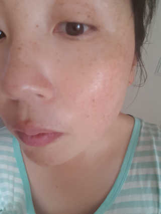 [더마허브] 주사팩 5종, 물광,백옥,태반,신데렐라 등 — 4점을 준 리뷰어가 2018년 3월 올린 사용 사진