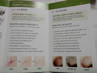 플러스셀라 시카골드 클렌징바 화산재팩 세트 — 5점을 준 리뷰어가 2020년 3월 올린 사용 사진