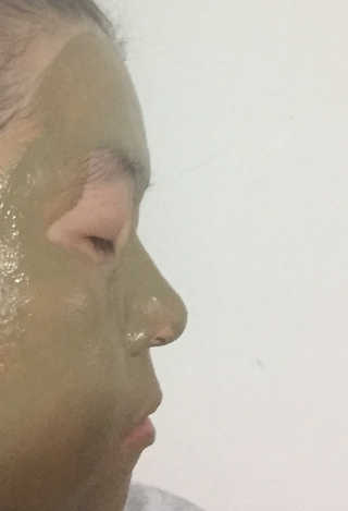 플러스셀라 시카골드 클렌징바 화산재팩 세트 — 5점을 준 리뷰어가 2020년 1월 올린 사용 사진