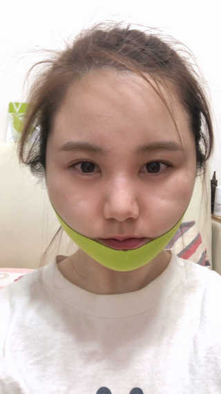 스케덤 시카 리프팅밴드 — 3.5점을 준 리뷰어가 2019년 4월 올린 사용 사진