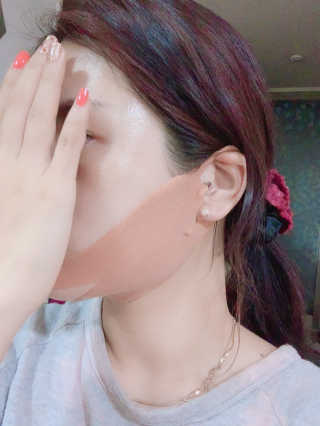 아이디플라코스메틱 아이디 페이스핏 마이너스 밴드 — 4.5점을 준 리뷰어가 2020년 1월 올린 사용 사진