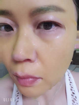 GoodDay Skincare GoodDay 강황 마스크 — 5점을 준 리뷰어가 2020년 2월 올린 사용 사진