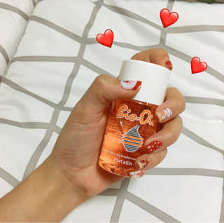 Bio-oil(바이오오일) 바이오오일(Bio-oil) — 5점을 준 리뷰어가 2016년 12월 올린 사용 사진