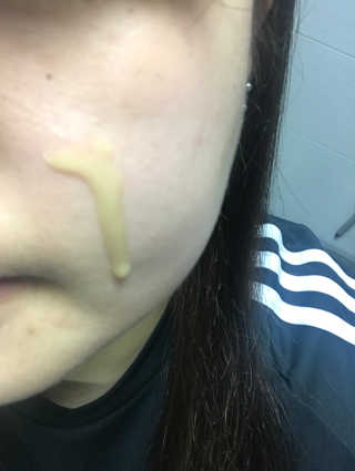 보타니티 [홍]조[진]정[결]케어 플라본 세럼 — 5점을 준 리뷰어가 2018년 5월 올린 사용 사진