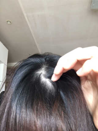 다슈코리아 다슈 안티 헤어로스 헤어쿠션 16g — 2점을 준 리뷰어가 2017년 6월 올린 사용 사진