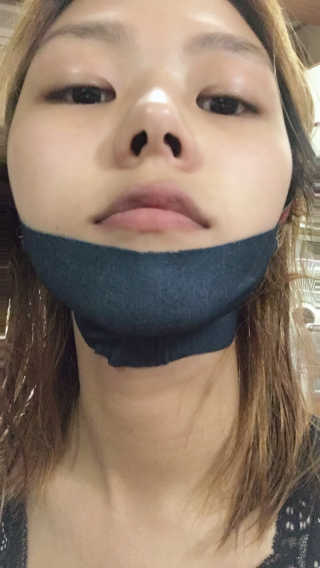 어웨이크어슬립 어슬립 페이스 리프트업 밴드 — 5점을 준 리뷰어가 2018년 6월 올린 사용 사진