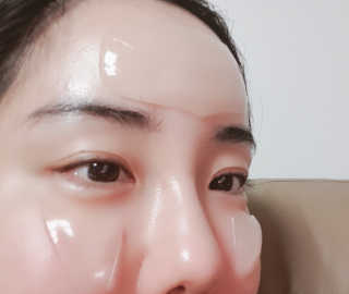 아이디플라코스메틱 아이디 페이스핏 플러스 패치 — 5점을 준 리뷰어가 2019년 10월 올린 사용 사진