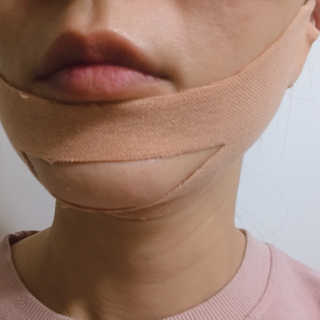 아이디플라코스메틱 아이디 페이스핏 마이너스 밴드 — 5점을 준 리뷰어가 2019년 11월 올린 사용 사진