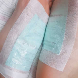 메디테라피 더마 릴렉스 힐링패치 — 3.83점을 준 리뷰어가 2018년 3월 올린 사용 사진
