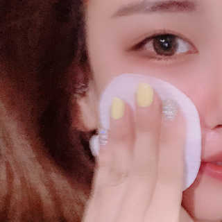 [후르디아] 약산성  모공 필링 패드(70매) — 3점을 준 리뷰어가 2019년 8월 올린 사용 사진
