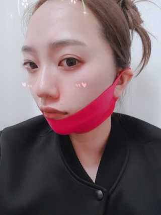 스케덤 펩타이드 리프팅밴드 — 5점을 준 리뷰어가 2019년 5월 올린 사용 사진