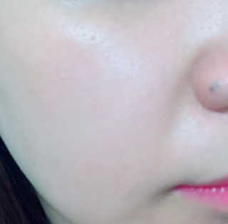 보타니티 [홍]조[진]정[결]케어 플라본 세럼 — 4.5점을 준 리뷰어가 2018년 5월 올린 사용 사진