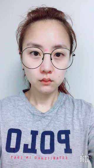 [더마허브] 스킨룩스 더마미스트 150ml — 4점을 준 리뷰어가 2018년 3월 올린 사용 사진