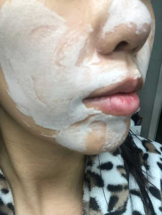 닥터펩티 제이앤코슈 펩타이드 볼륨 에센스 — 5점을 준 리뷰어가 2019년 4월 올린 사용 사진