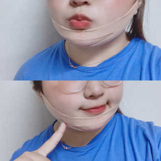 아이디플라코스메틱 아이디 페이스핏 마이너스 밴드 — 4점을 준 리뷰어가 2019년 10월 올린 사용 사진