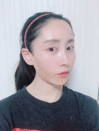 아이디플라코스메틱 아이디 페이스핏 마이너스 밴드 — 4.5점을 준 리뷰어가 2019년 10월 올린 사용 사진
