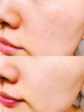 pinksoda님이 올린 리뷰 사진 2