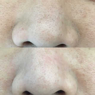 메디힐 슬리핑 멜팅 코팩 — 5점을 준 리뷰어가 2020년 1월 올린 사용 사진