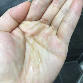 아로마피츠 토니피앙[림프배농 아로마 오일] — 4점을 준 리뷰어가 2019년 10월 올린 사용 사진