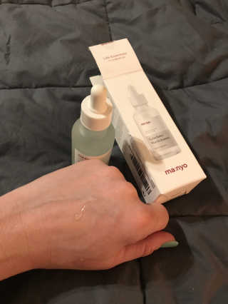 [마녀 공장] 발가락 토미 니아신 에센스 50ml — 5점을 준 리뷰어가 2019년 3월 올린 사용 사진
