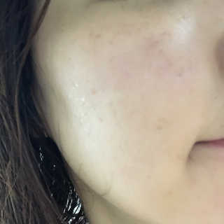 놀스 더블 듀티 미스트 110ml — 5점을 준 리뷰어가 2018년 7월 올린 사용 사진