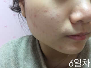 23years old 바데카실P — 3.5점을 준 리뷰어가 2017년 1월 올린 사용 사진