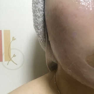 에슬레나 엑스트라 밸런싱 힐링 마스크 10장 — 4.33점을 준 리뷰어가 2017년 10월 올린 사용 사진