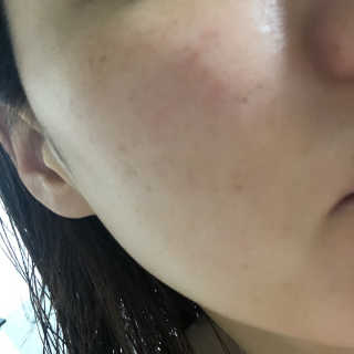 라이징스타 화이트 토마토 브이크림 — 4점을 준 리뷰어가 2018년 7월 올린 사용 사진
