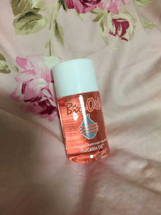 Bio-oil(바이오오일) 바이오오일(Bio-oil) — 4점을 준 리뷰어가 2017년 1월 올린 사용 사진