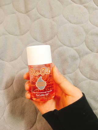 Bio-oil(바이오오일) 바이오오일(Bio-oil) — 5점을 준 리뷰어가 2016년 12월 올린 사용 사진