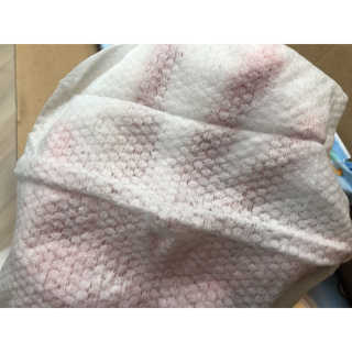 보솜이 아기물티슈 베이비케어 푸에디션 캡 74매 10입 — 3점을 준 리뷰어가 2019년 4월 올린 사용 사진