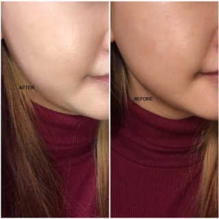 예림님이 올린 리뷰 사진 2