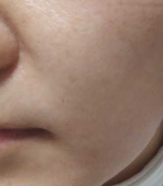 다슈코리아 다슈 솔루션 시카 쉴드 선스틱 — 3점을 준 리뷰어가 2020년 2월 올린 사용 사진
