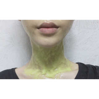 W.피부연구소 스탑에이징 목주름팩 — 4점을 준 리뷰어가 2018년 11월 올린 사용 사진