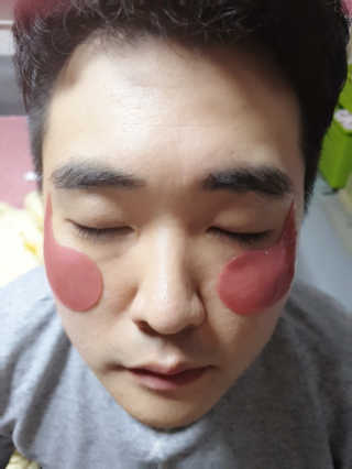 푸츄푸츄 Real repair skin cell premium patch — 5점을 준 리뷰어가 2018년 11월 올린 사용 사진