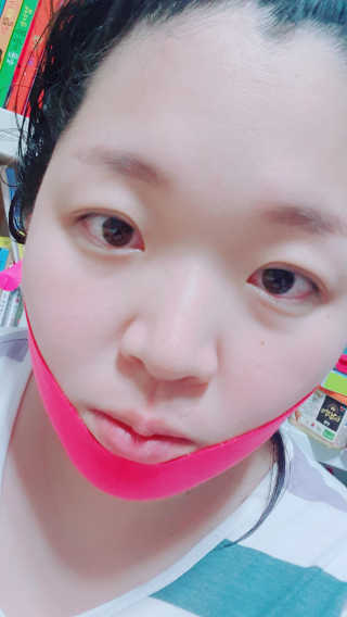 스케덤 펩타이드 리프팅밴드 — 4점을 준 리뷰어가 2019년 6월 올린 사용 사진