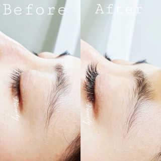 Viewty Skin and Lash [ViewtySkin＆Lash] 종아리 림프순환 부종관리 — 5점을 준 리뷰어가 2019년 2월 올린 사용 사진