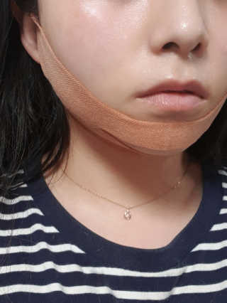 아이디플라코스메틱 아이디 페이스핏 마이너스 밴드 — 4점을 준 리뷰어가 2020년 4월 올린 사용 사진