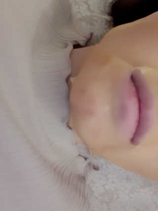 GoodDay Skincare GoodDay 강황 마스크 — 4점을 준 리뷰어가 2020년 2월 올린 사용 사진