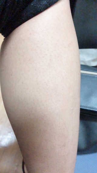 아미니 울트라 시어 바디 버터 — 4점을 준 리뷰어가 2018년 12월 올린 사용 사진