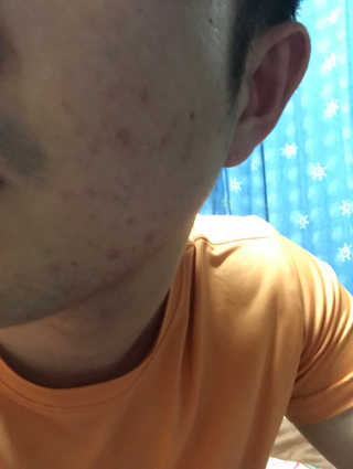 23years old 바데카실 닥토 — 3.67점을 준 리뷰어가 2017년 11월 올린 사용 사진