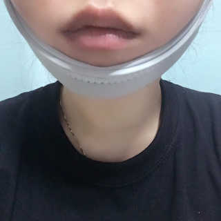 메디미 브이미 업 2스텝 브이라인벨트 — 4.33점을 준 리뷰어가 2017년 6월 올린 사용 사진