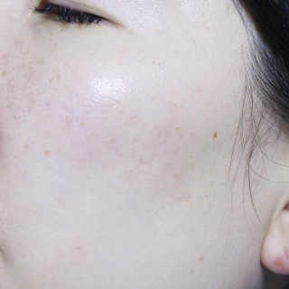 닥터웰메이드원 압구지엔 다이아몬드 링거앰플 — 5점을 준 리뷰어가 2018년 12월 올린 사용 사진