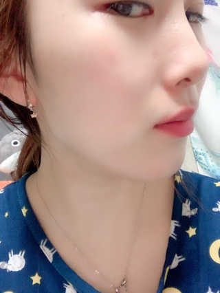 닥터웰메이드원 압구지엔 다이아몬드 링거앰플 — 4점을 준 리뷰어가 2019년 1월 올린 사용 사진